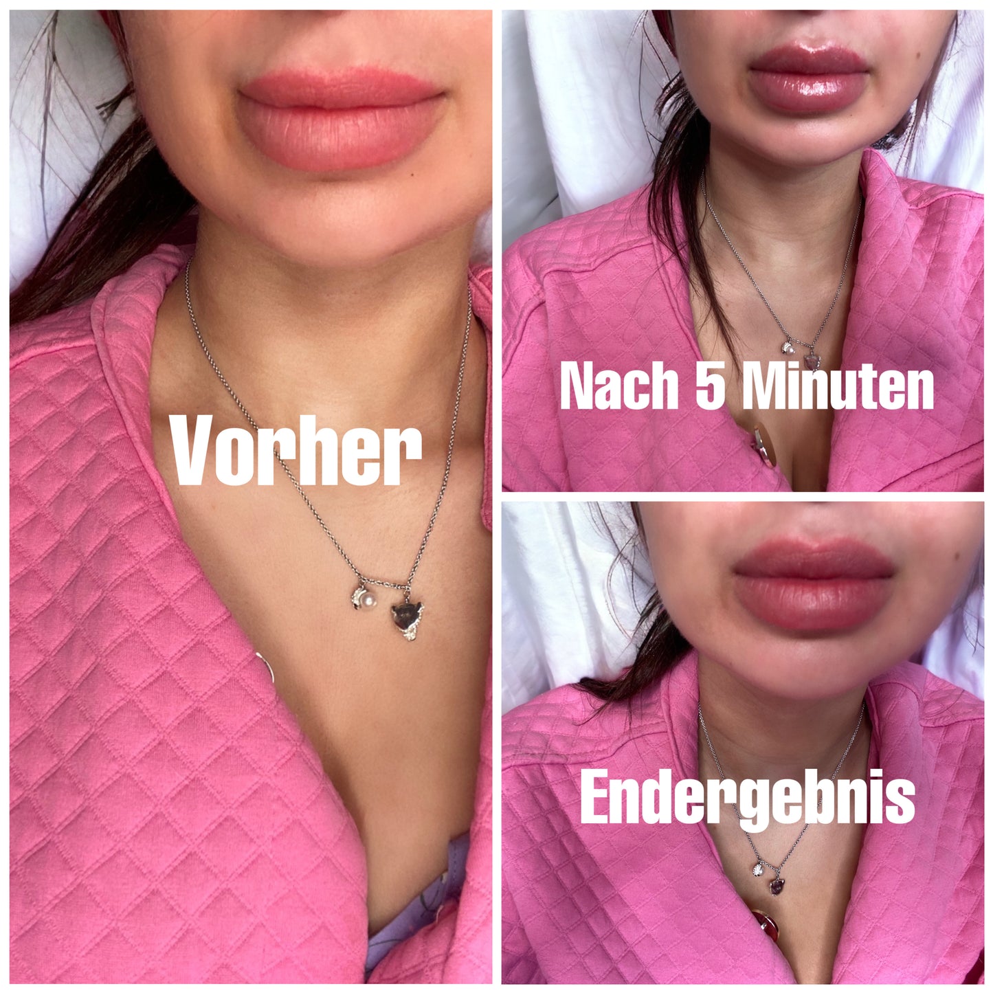 Lip Plumper Kiss Beauty